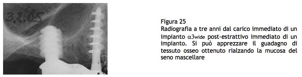 Schermata 2017-08-01 alle 22.21.53.jpg