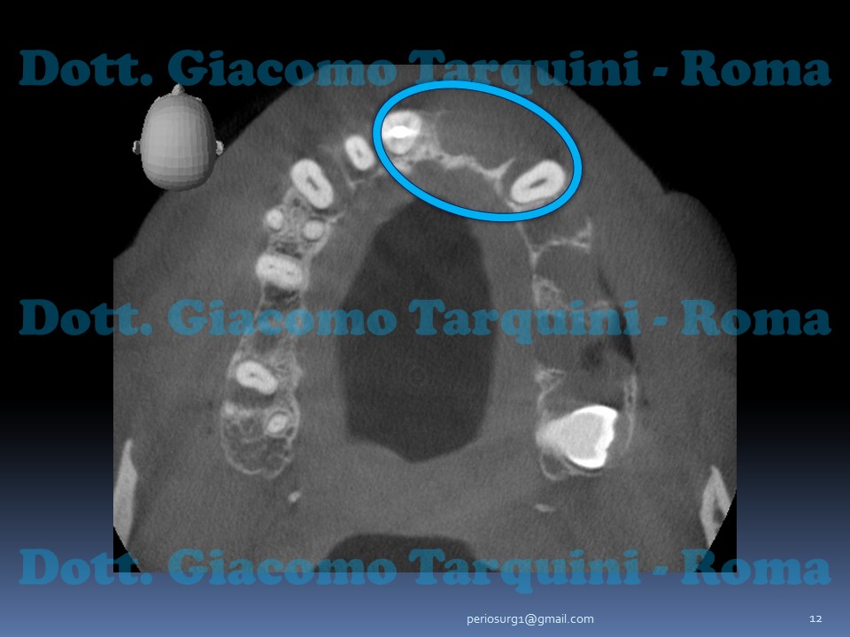 Diapositiva12.JPG.45d4ffb346a5bba62aca81fe3627f53a.JPG