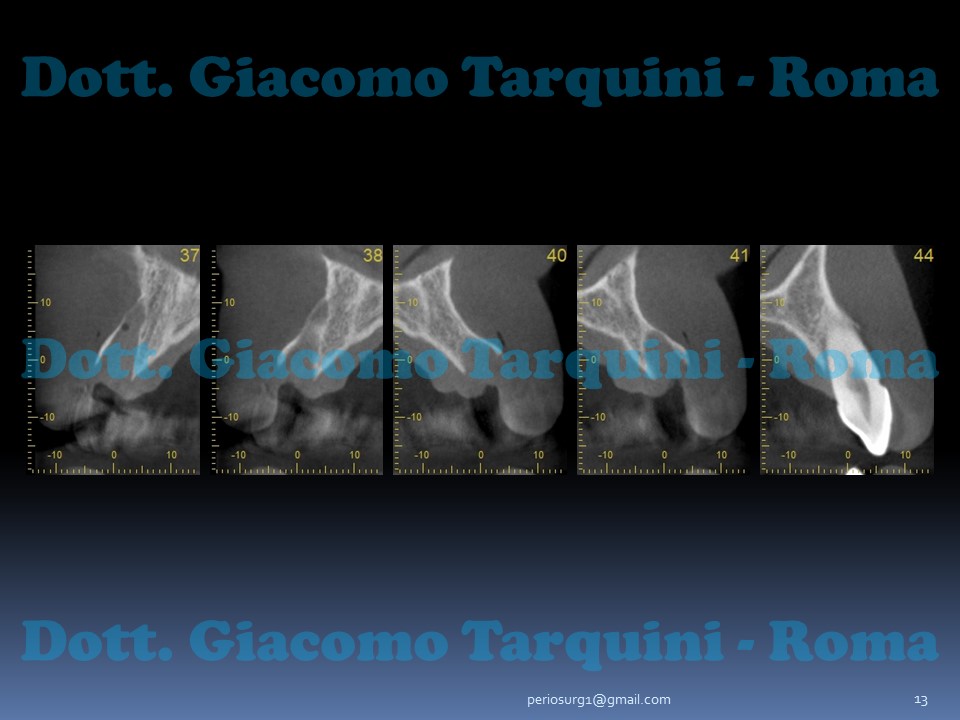 Diapositiva13.JPG.89afc76838b92916612ff1403a9f207c.JPG