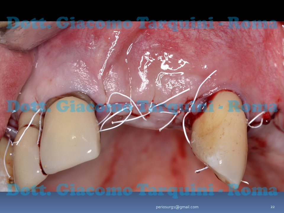 Diapositiva22.JPG.f1e2bc46b4d6c21fadf4cd3af93d8889.JPG