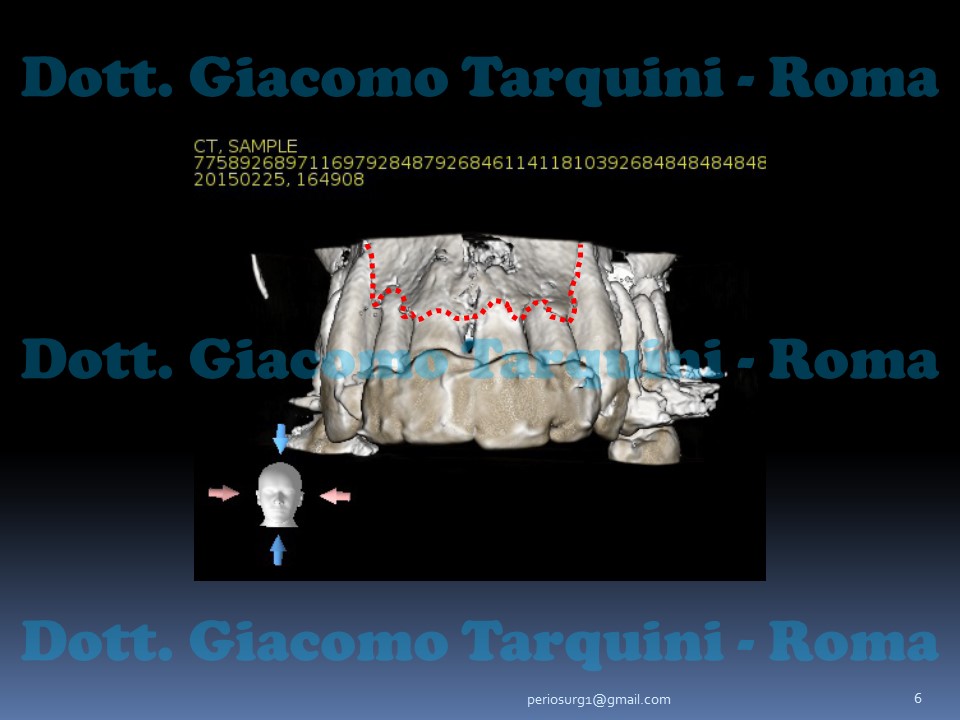 Diapositiva6.JPG.2c39de021e8f391c9cec4be84e76f9e9.JPG