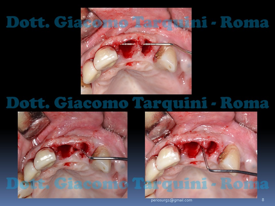 Diapositiva8.JPG.b8ad10c34229634a2f48b568c2c37036.JPG