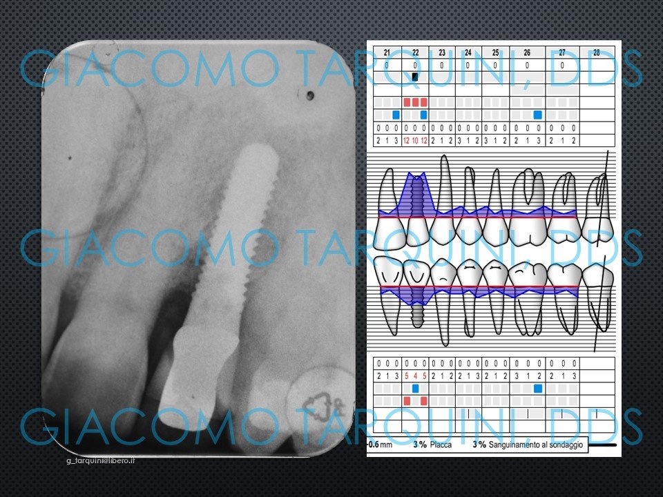 Diapositiva2.JPG.a5d528d8cc76a6e0bf8d7ca7635c3e49.JPG