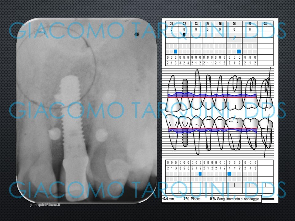 Diapositiva31.JPG.dda23a00c35651a252ffaf50d41075de.JPG