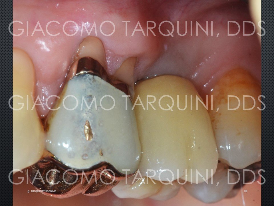 Diapositiva18.JPG.29c033e73e4ba67294c29fbc6051c59f.JPG