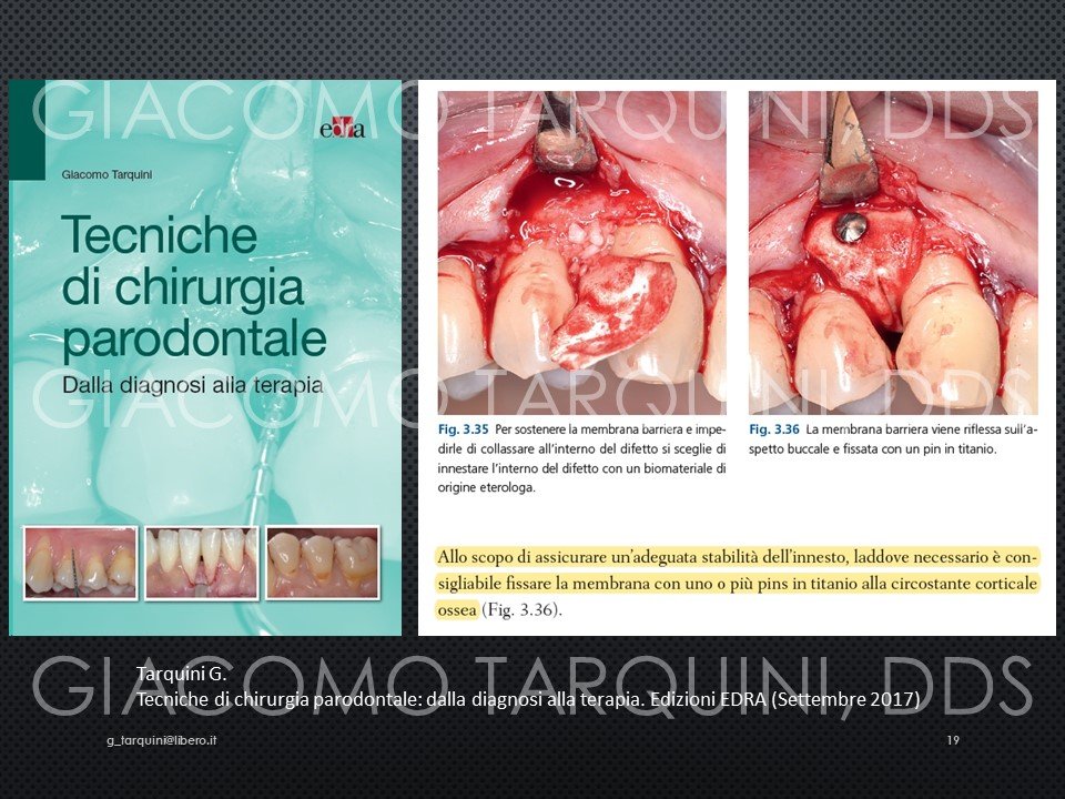 Diapositiva19.JPG.82ef05e386177fc43de97e7385da2015.JPG