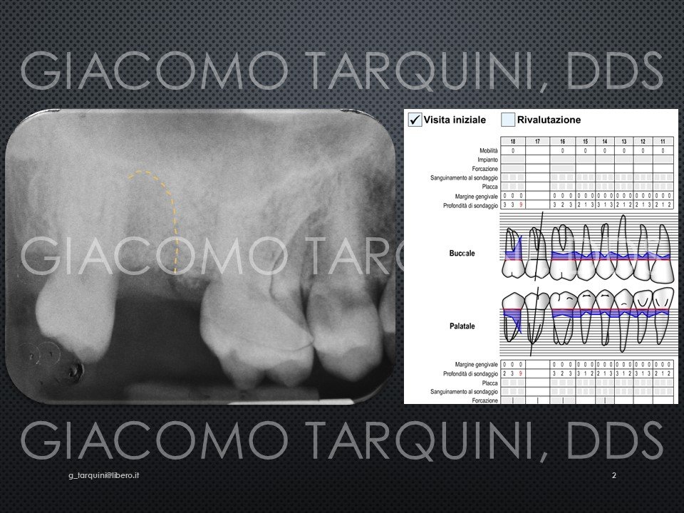 Diapositiva2.JPG.70a92a039bd4233b5bc6ed60c15186ed.JPG