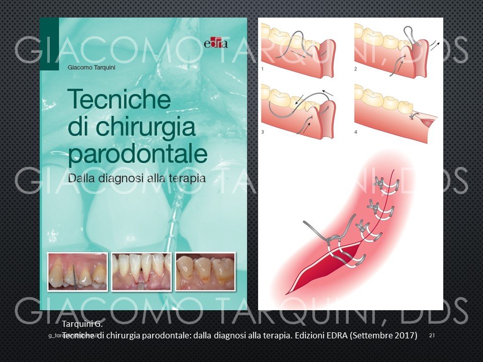 Diapositiva21.JPG.941d3a4f080f787cb2da4b1c81b3519f.JPG