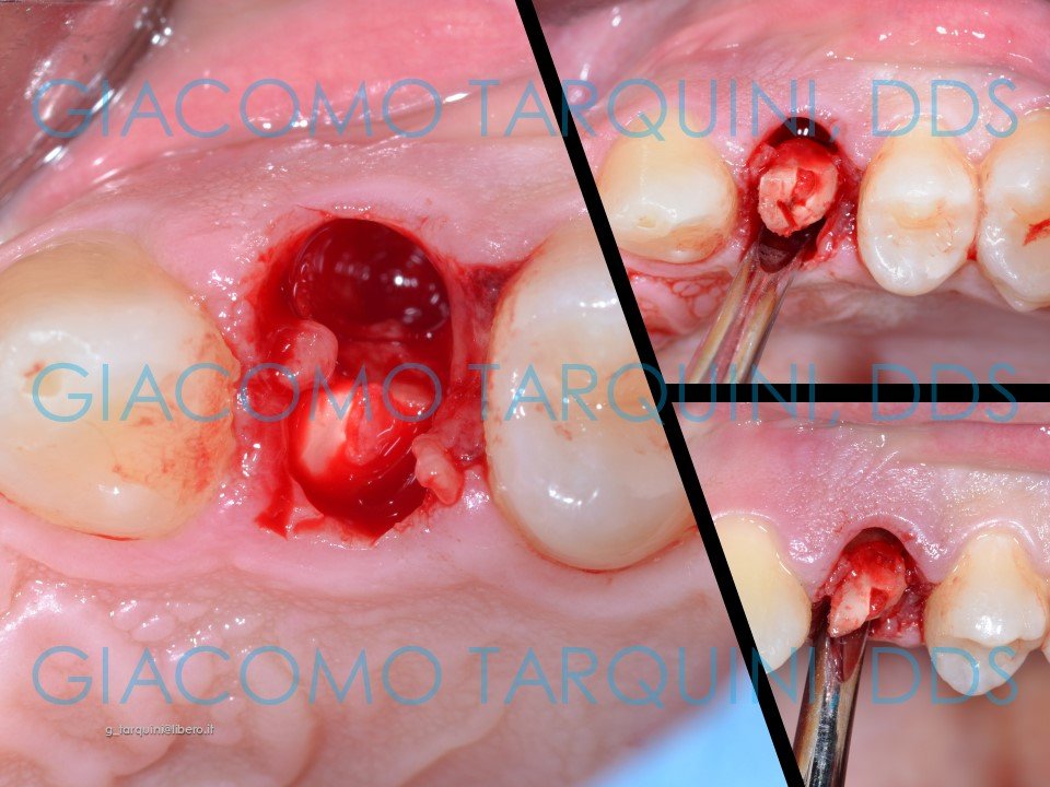 Diapositiva4.JPG.953f45a584e4402abff3f8b32aaf8187.JPG