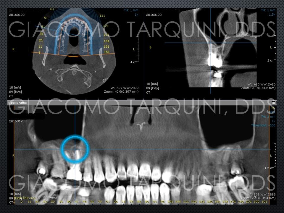 Diapositiva3.JPG.83db94b32f81d8d4f2dd1a68ea62fb7b.JPG