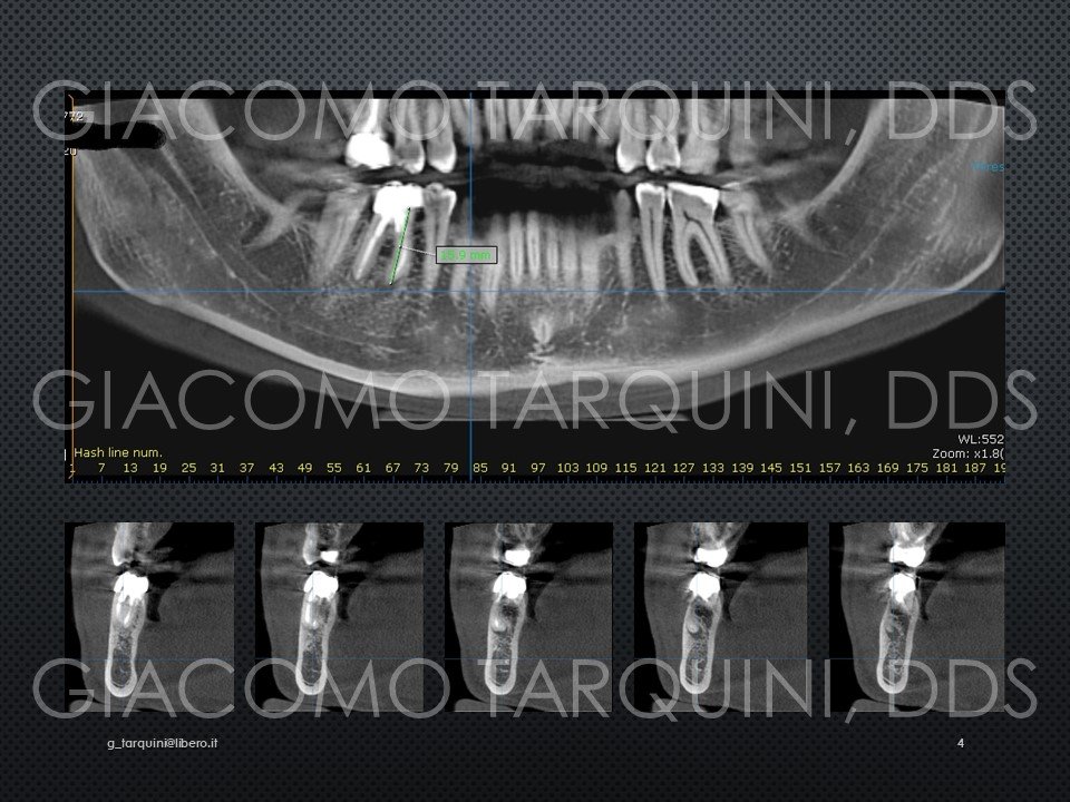 Diapositiva4.JPG.d6f0036167b59732a5859d313a879d48.JPG