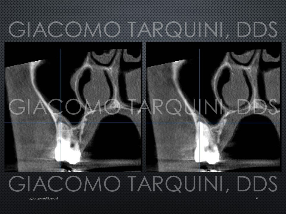 Diapositiva4.JPG.df10f564929655d5d88b04b0b0dd6b5d.JPG