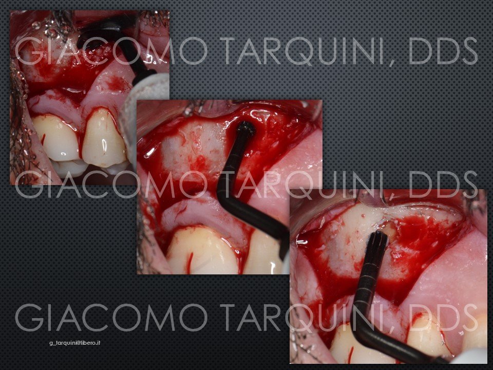 Diapositiva7.JPG.9390500d13d1b0033330fe65e86af9b3.JPG