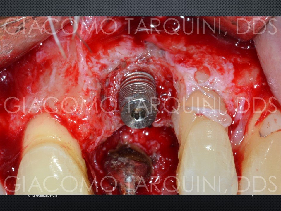 Diapositiva9.JPG.1eb01f37fdffcd3f09a11cafdd5bc3e4.JPG