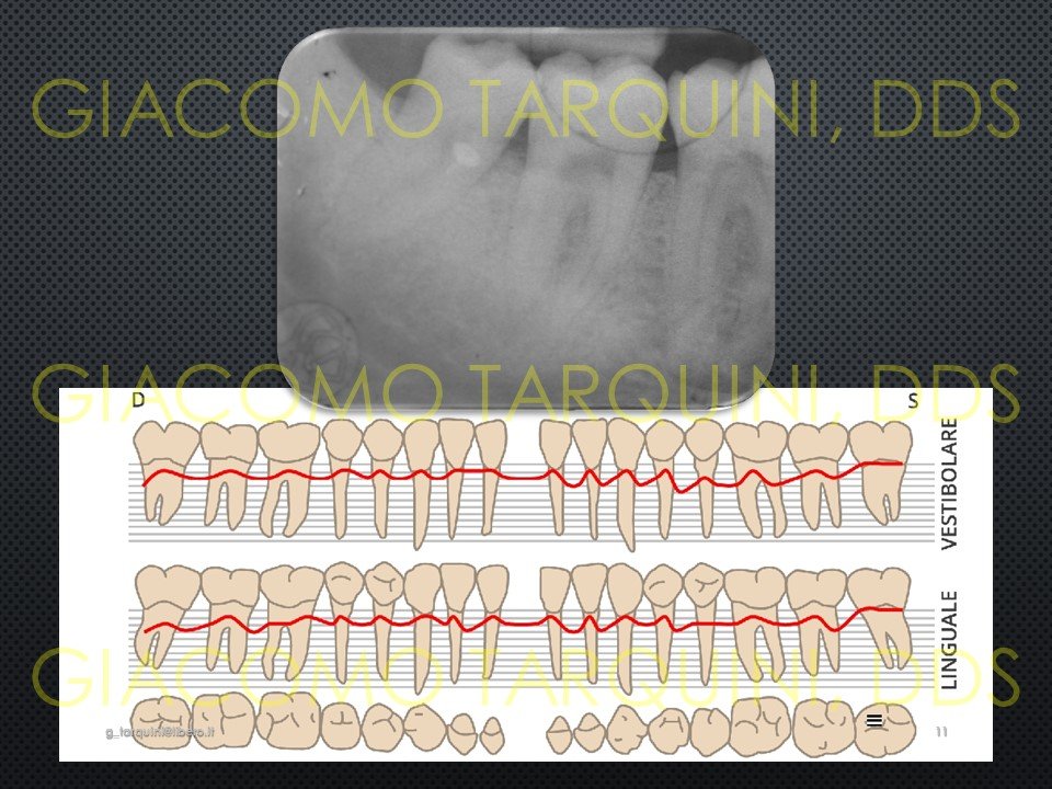 Diapositiva11.JPG.307089d072335b29a6d8ba33975c894e.JPG