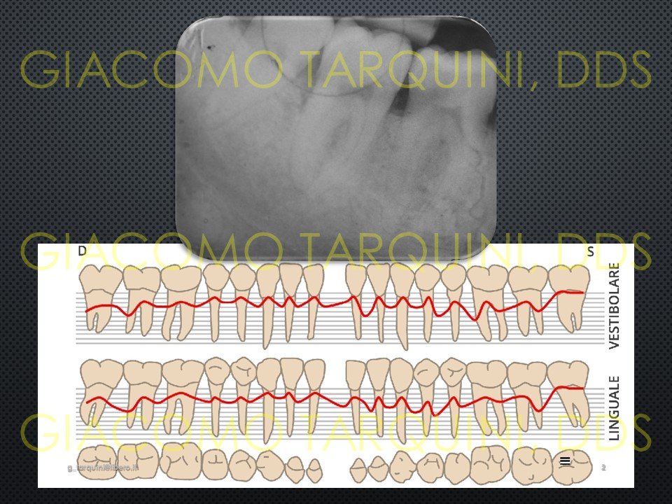 Diapositiva2.JPG.a4c0548b47375fcfcc9d96b20ce37f62.JPG