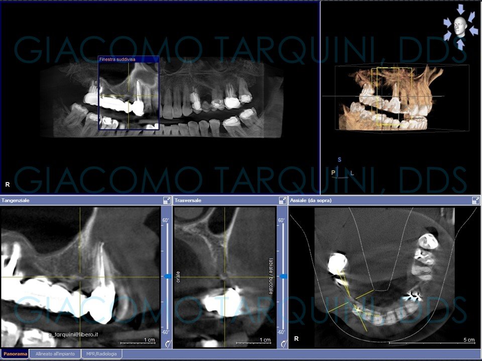 Diapositiva2.JPG.53a47649c78ef68b20dbb003eda8a3c9.JPG