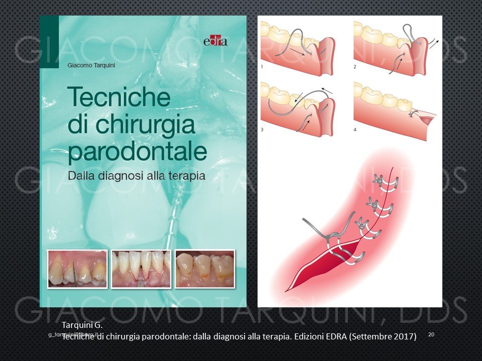 Diapositiva20.JPG.c31f5e83459fe87bd98e28dcc147e71d.JPG