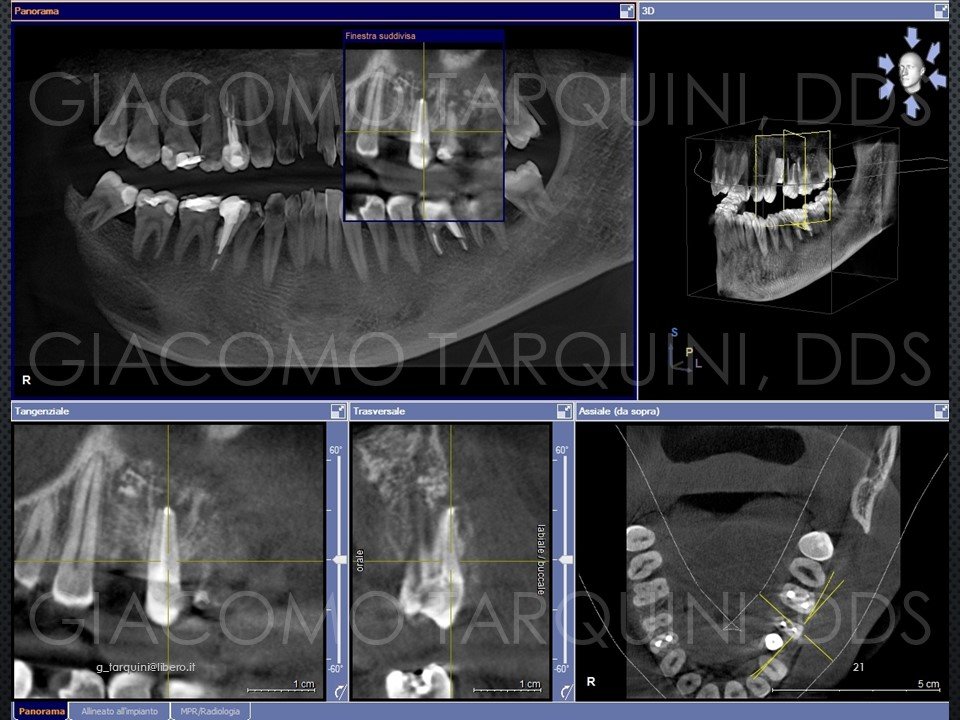 Diapositiva21.JPG.6cfa9a44465a8885832d5f119598c1f1.JPG