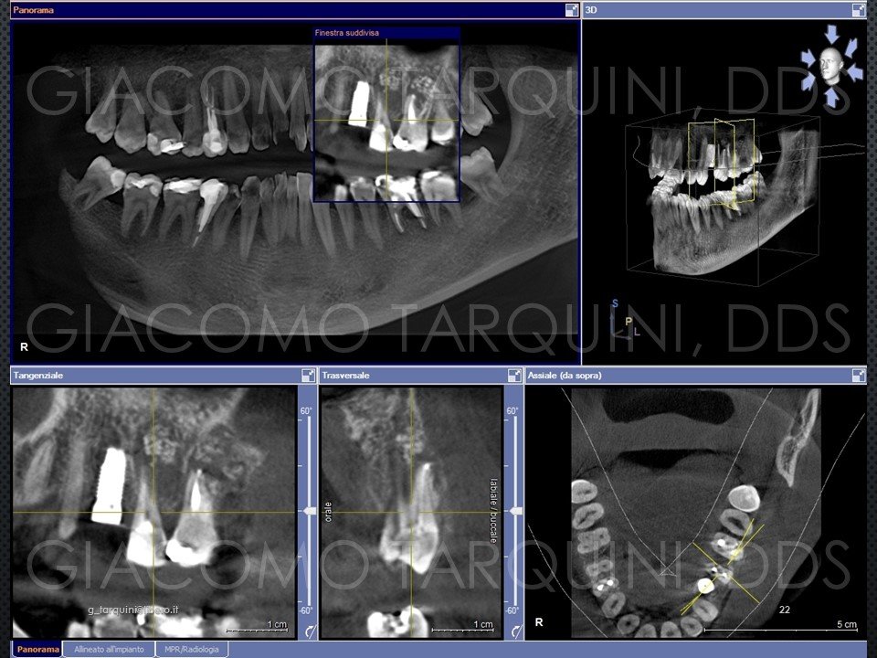 Diapositiva22.JPG.dad4e63ae2ccc46d18a07cd9d1f2a53b.JPG