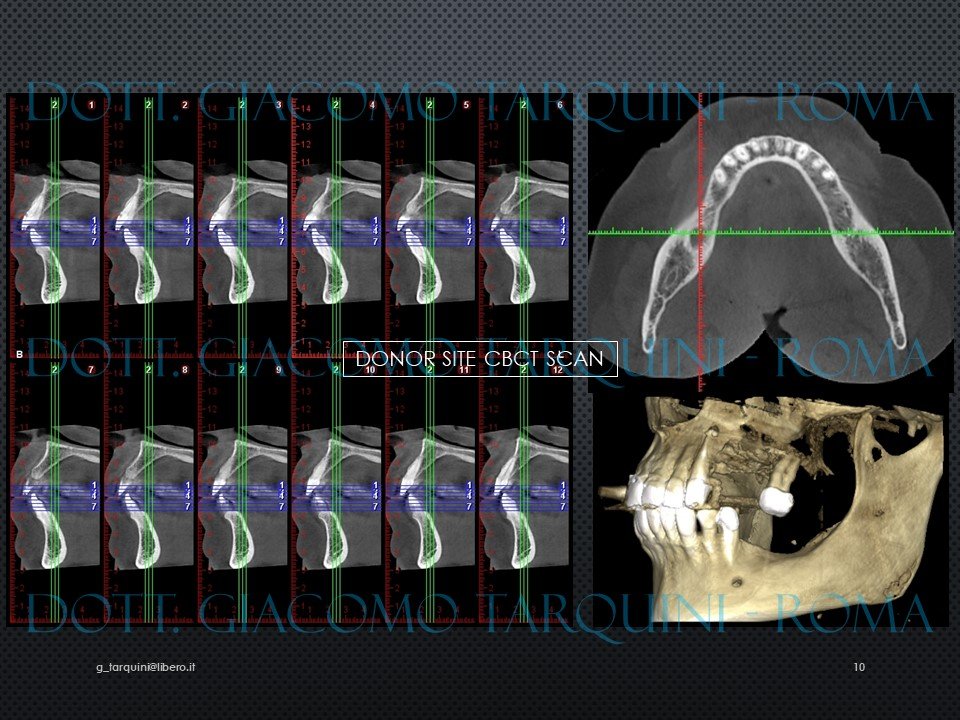 Diapositiva10.JPG.71154ce852a5f57808f9c6a5246ca316.JPG