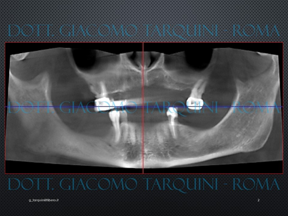 Diapositiva2.JPG.a46a4afadda39e376c071bdd6d399a35.JPG