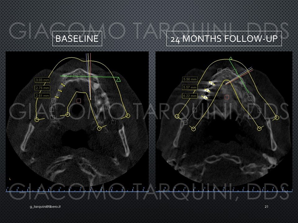 Diapositiva21.JPG.efc363f8d389724390bc13358c99a45a.JPG