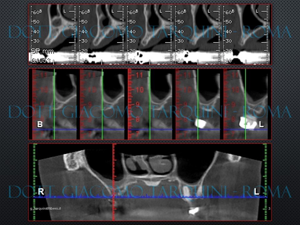 Diapositiva3.JPG.94306a609cb4eb6429d4975eb5fab34e.JPG