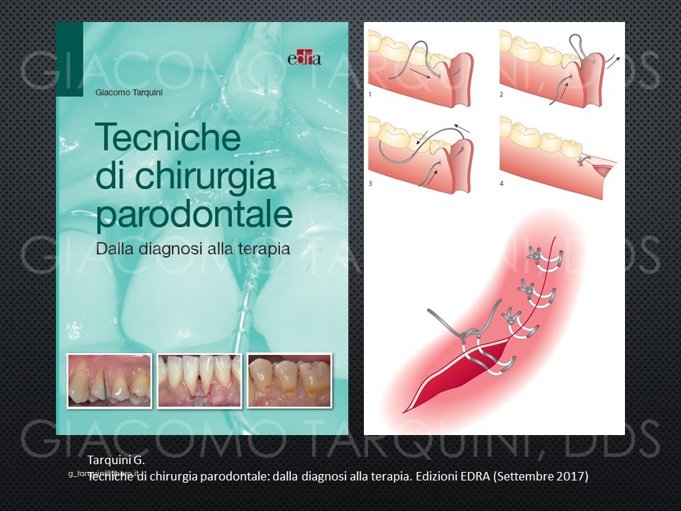 Diapositiva28.JPG.0b390c77e82a83c4d634738155fd4bca.JPG