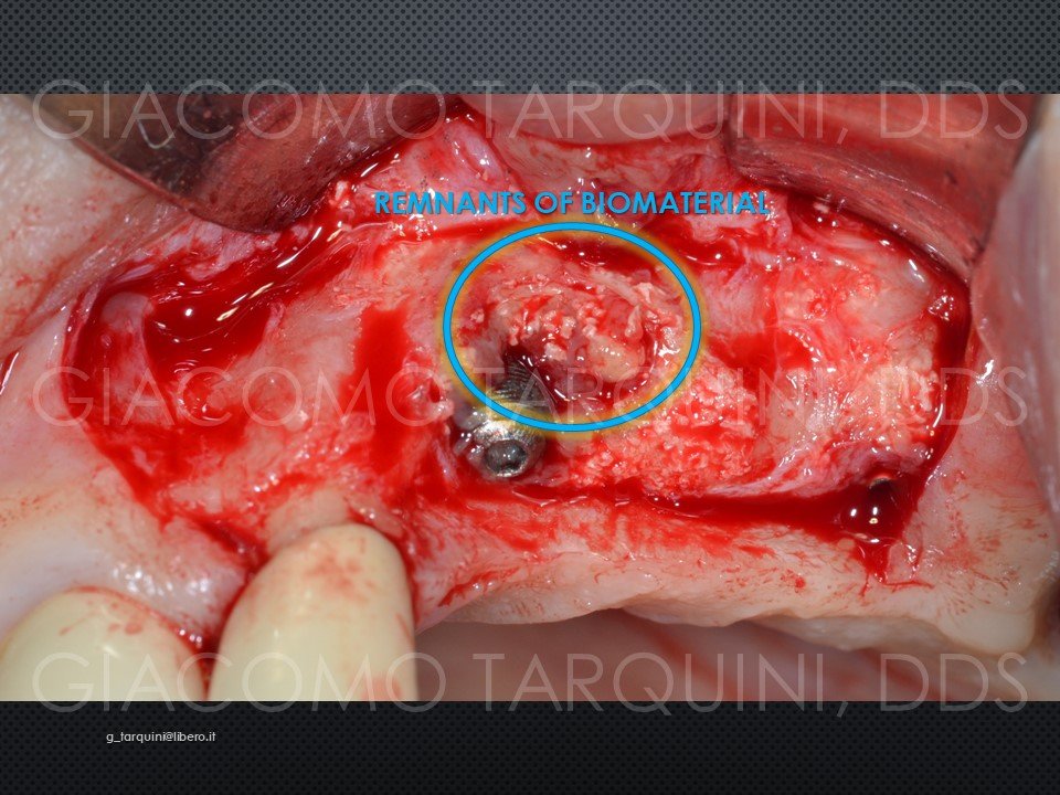 Diapositiva7.JPG.1415c7714feddcf0d9bfba77ea76ab88.JPG