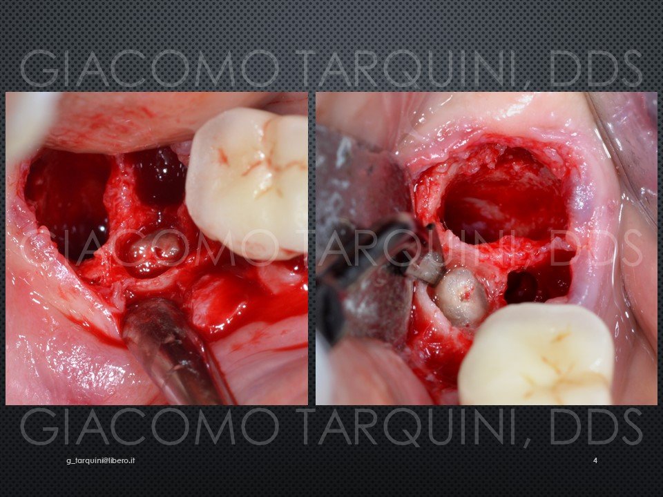 Diapositiva4.JPG.8555a7208a3e6622dd1647c3e51a5d26.JPG