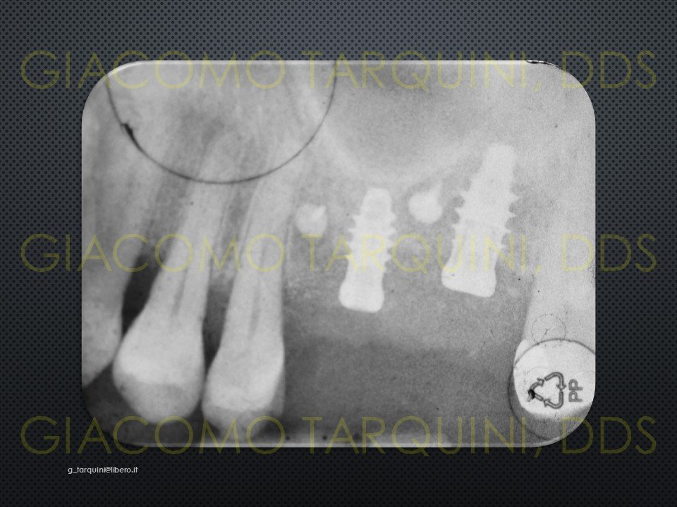 Diapositiva21.JPG.a5da8e274364a8a6471ea1c180ca256b.JPG