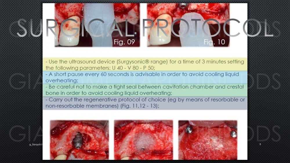 Diapositiva9.thumb.JPG.553a6c06f605654c613094ad4d16334c.JPG