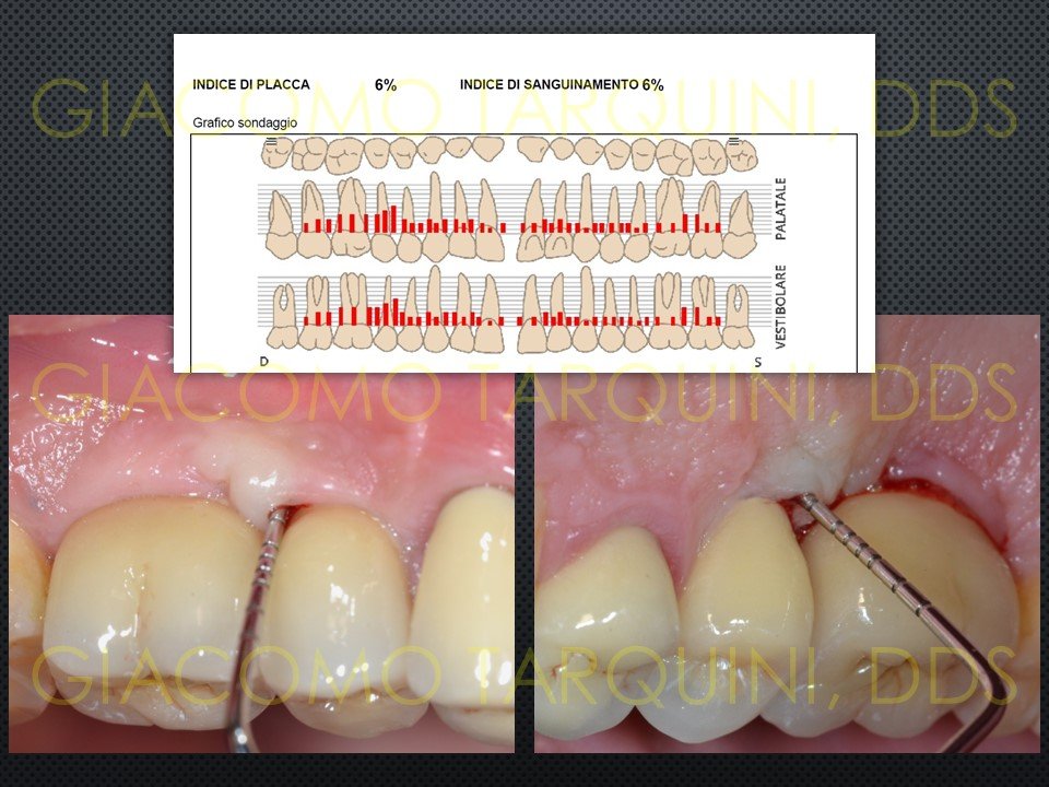 Diapositiva2.JPG.b045cf72567e9b377aac88f293312bda.JPG