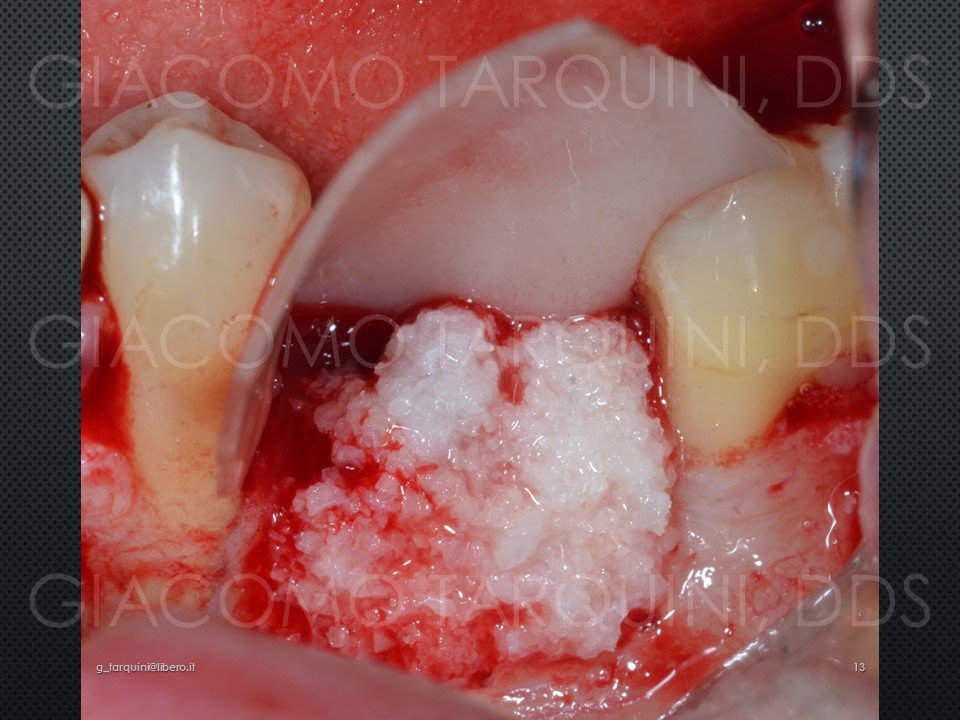 Diapositiva13.JPG.e360b56e44bdff6df3378677c038fd95.JPG