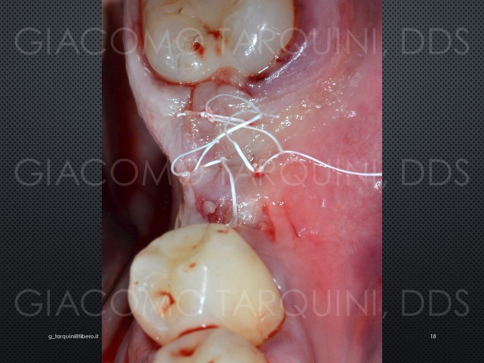 Diapositiva18.JPG.206db9c28ab9f29e911c6658668afd04.JPG