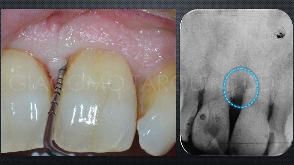 Diapositiva1.thumb.JPG.a0d9dc19bb04e68e721c31d7998d75ed.JPG