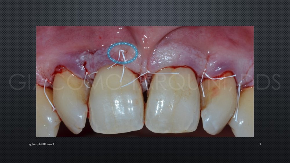 Diapositiva9.thumb.JPG.53b70c16ba8be3968e983329fc7bc746.JPG