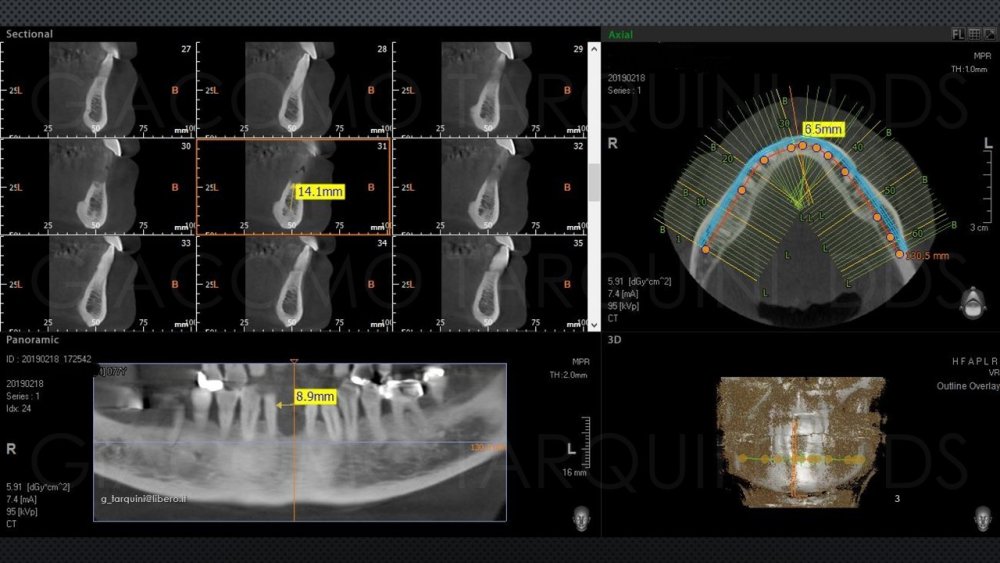 Diapositiva3.thumb.JPG.f23eff39afd64dc15bc1cae7fb3e60fc.JPG