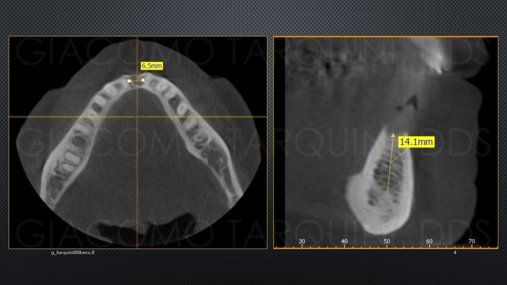 Diapositiva4.thumb.JPG.f163160790019c2f07832e12a2898554.JPG