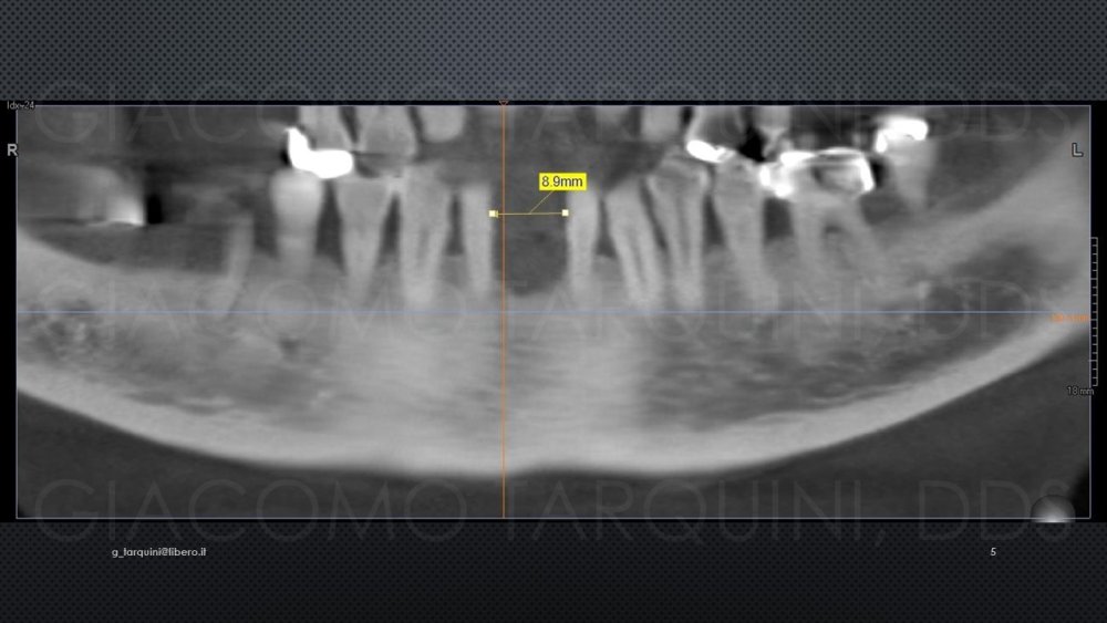 Diapositiva5.thumb.JPG.487c2f90ceb0831a45e5cd2dc8ea8111.JPG