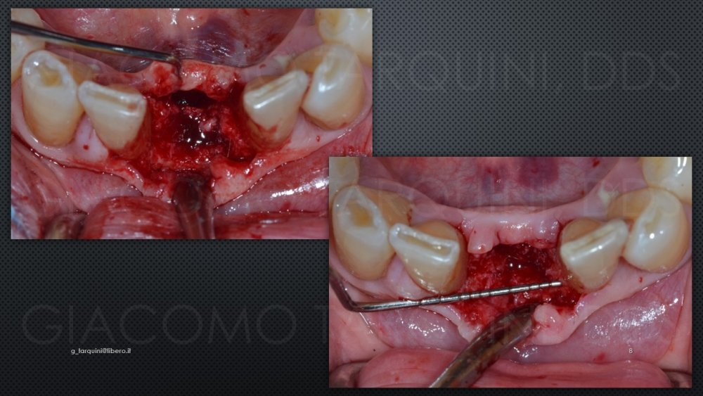 Diapositiva8.thumb.JPG.d09f508463520a2cb11515264849b172.JPG