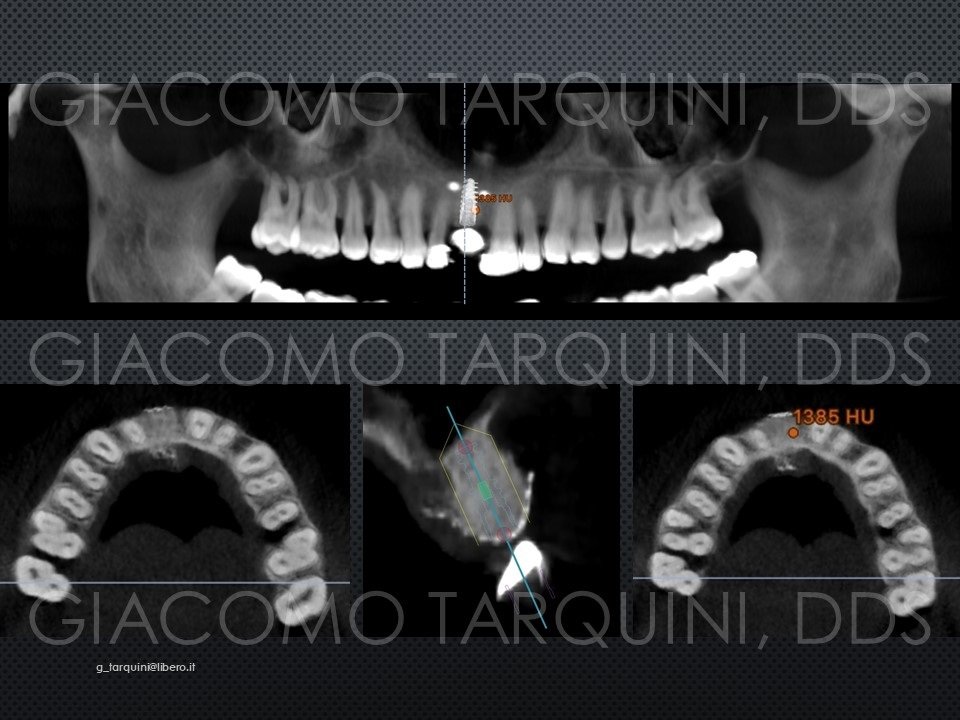 Diapositiva20_14092697.jpg.1cd4a961fd4868e8d5b306bdbe0ab3ce.jpg