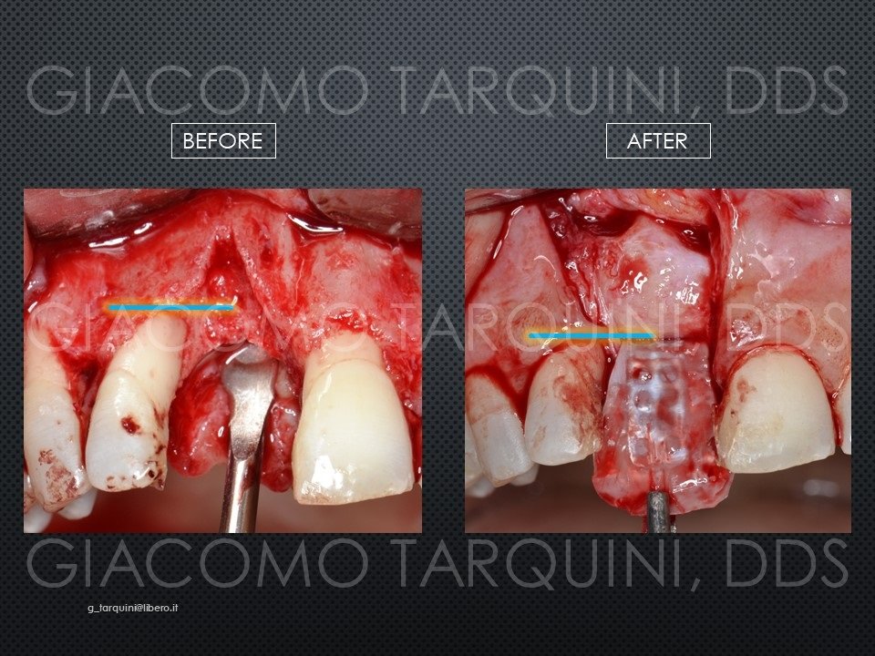 Diapositiva26_140926423.jpg.c7abd4c12df633a8680114563688dfac.jpg