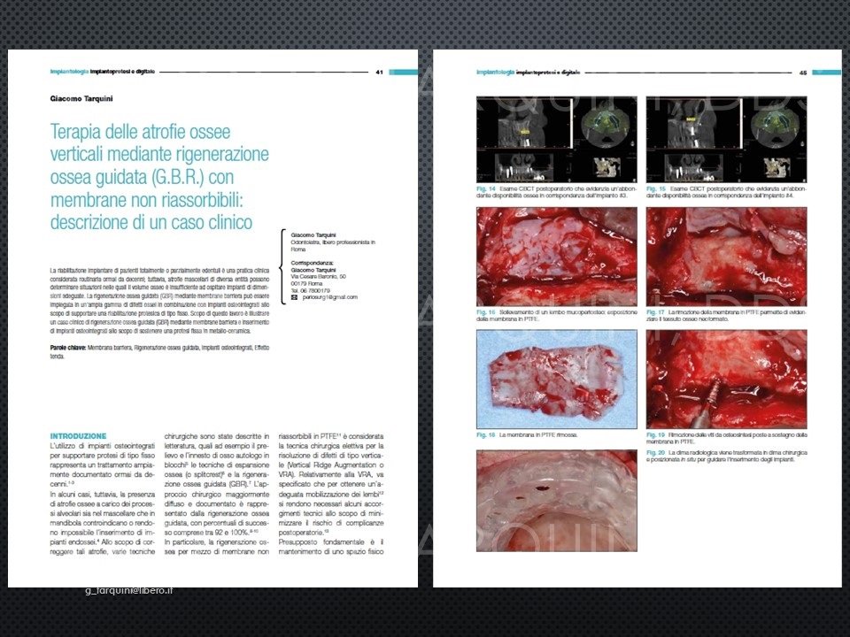 Diapositiva33_140926986.jpg.535f5f272a024523c4fd5d97596a8528.jpg