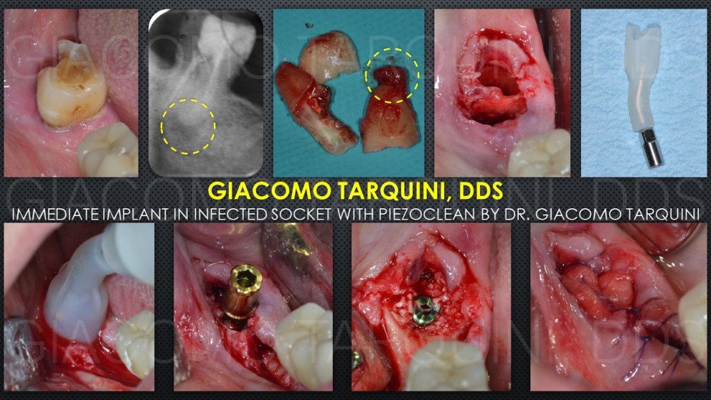 CLINICAL_CASES.thumb.jpg.dc6ac31c1ccad5fb4ccc4163f0597cd6.jpg