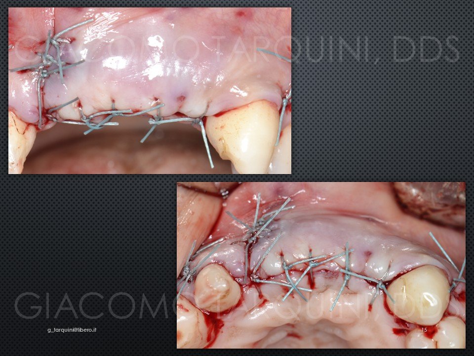 Diapositiva16.JPG.283962ffdd39c3d07310da1bd670eefb.JPG