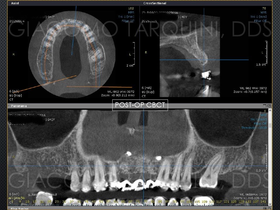 Diapositiva17.JPG.da92601ee4b311bb5456824cfcfba099.JPG