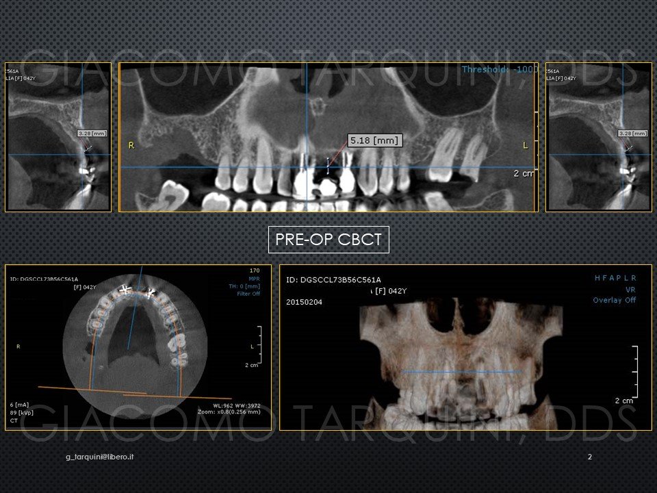 Diapositiva2.JPG.c6d094c21bdaf7ff232403236ff99b7e.JPG