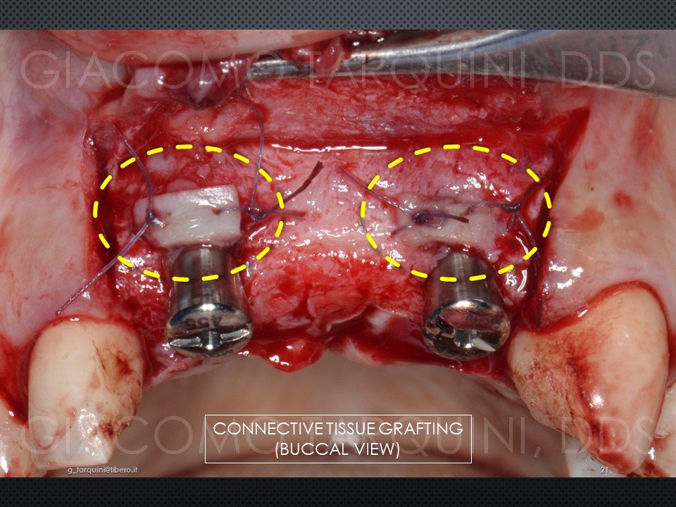 Diapositiva22.JPG.dafb9d7e73e8491598d22426c6b3017f.JPG